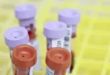 Fidži proglasio vanredno stanje zbog HIV-a: Zaražen svaki 60. stanovnik