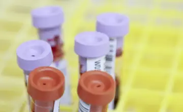 Fidži proglasio vanredno stanje zbog HIV-a: Zaražen svaki 60. stanovnik