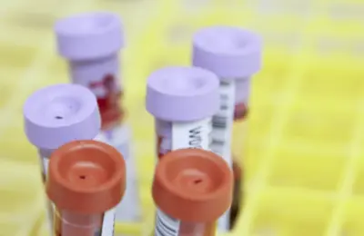 Fidži proglasio vanredno stanje zbog HIV-a: Zaražen svaki 60. stanovnik