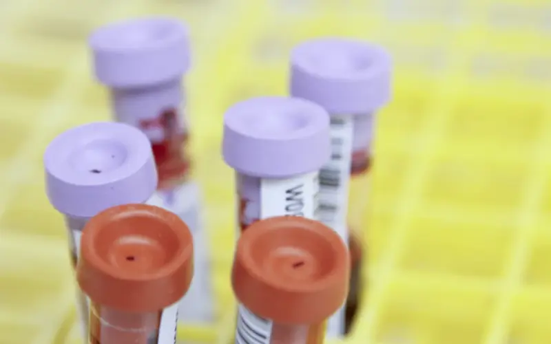Fidži proglasio vanredno stanje zbog HIV-a: Zaražen svaki 60. stanovnik