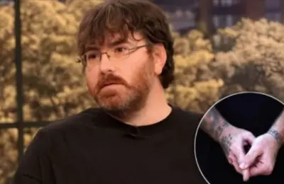 Imao je penis svega 0,97 centimetara: Posle operacije život mu se promenio