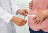 Predstavljen novi vodič za gojaznost: Srbija prva u svetu u borbi protiv bolesti