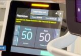U Sremskoj Kamenici prvi put primenjen laser u lečenju složenih suženja srčanih arterija